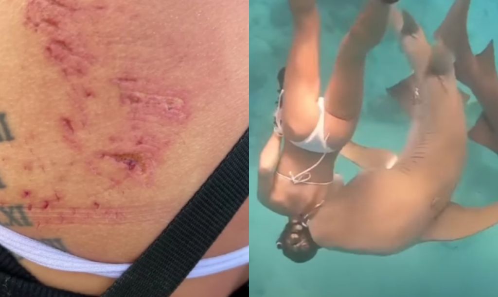 Στιγμές τρόμου για κολυμβήτρια: Τη δάγκωσε καρχαρίας 100 κιλών